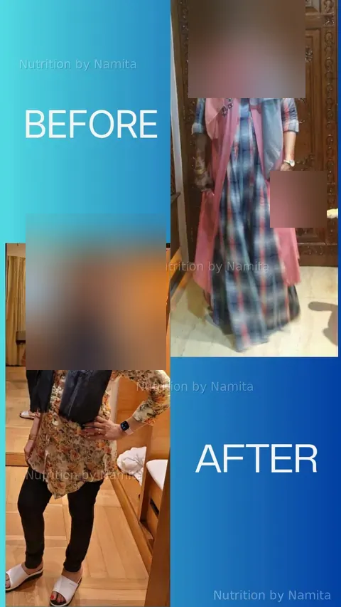 Sumita Shrivastava Before and After - Nutrition by Namita
